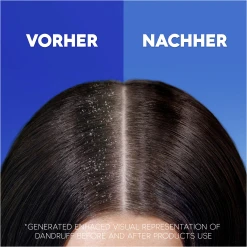 Head & Shoulders Anti-Schuppen Shampoo Apple Fresh -Dresdner Essenz shop MAM 10410792 SHOP IMAGE 1.4